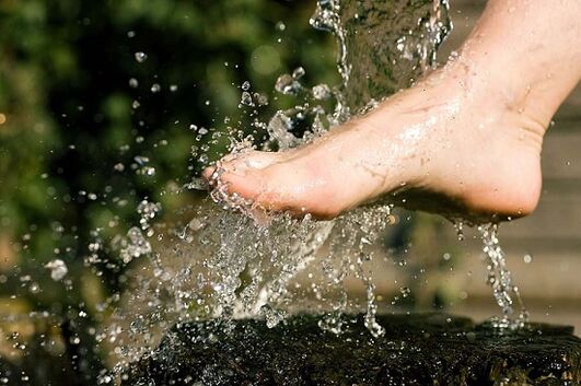 Measures to prevent varicose veins on the legs