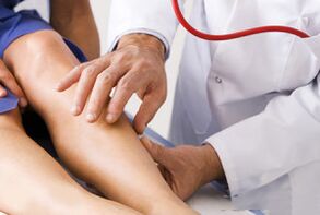 Varicose veins on the legs