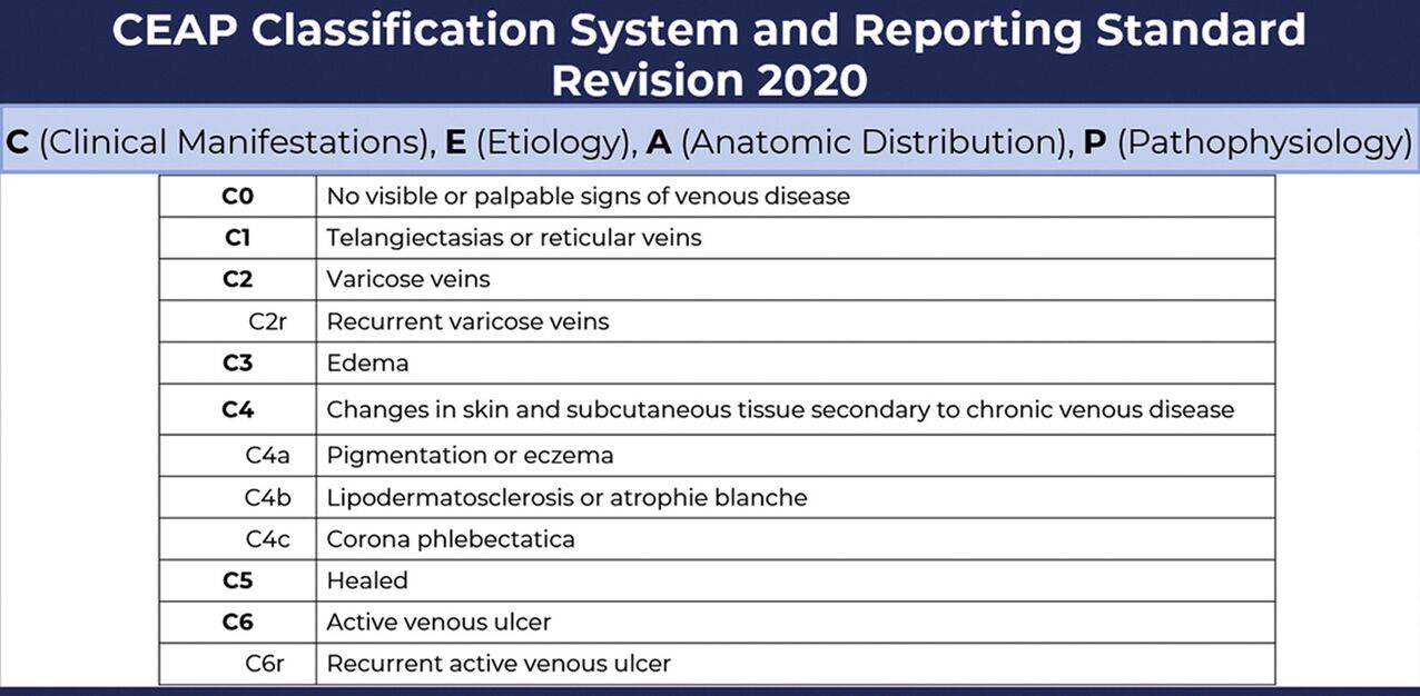 Stages of varicose veins according to the CEAP classification as amended in 2020