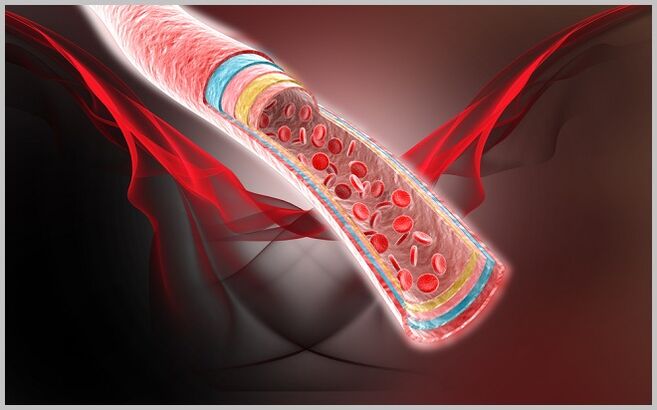 Blood circulation in the veins after treatment of varicose veins with gel