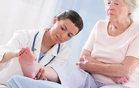 See a doctor if you have symptoms of varicose veins