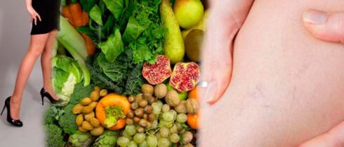 forbidden foods for varicose veins