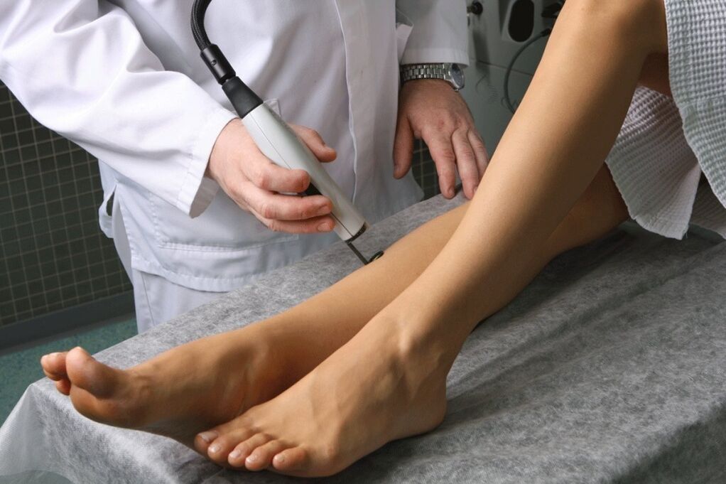 Treatment of varicose veins by a phlebologist